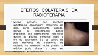EFEITOS COLÁTERAIS DA 
RADIOTERAPIA 
• Muitas pessoas que recebem 
radioterapia apresentam problemas de 
pele, como ressecamento, coceira, 
bolhas ou descamação. Esses 
problemas são normalmente resolvidos 
dentro de poucas semanas após o 
fim do tratamento. Se os danos na 
pele derivados do tratamento de 
radiação se tornarem muito graves, o 
médico pode alterar a dose ou 
esquema de tratamentos. 
 