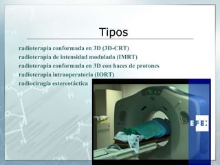 Tipos
radioterapia conformada en 3D (3D-CRT)
radioterapia de intensidad modulada (IMRT)
radioterapia conformada en 3D con haces de protones
radioterapia intraoperatoria (IORT)
radiocirugía estereotáctica
 