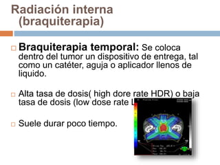 Radiación interna
(braquiterapia)
 Braquiterapia temporal: Se coloca
dentro del tumor un dispositivo de entrega, tal
como un catéter, aguja o aplicador llenos de
liquido.
 Alta tasa de dosis( high dore rate HDR) o baja
tasa de dosis (low dose rate LDR).
 Suele durar poco tiempo.
 