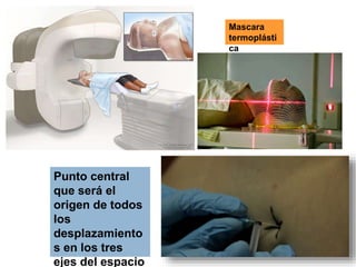Punto central
que será el
origen de todos
los
desplazamiento
s en los tres
ejes del espacio
Mascara
termoplásti
ca
 