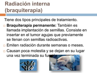 Radiación interna
(braquiterapia)
Tiene dos tipos principales de tratamiento.
 Braquiterapia permanente: También es
llamada implantación de semillas. Consiste en
insertar en el tumor agujas que previamente
se llenan con semillas radioactivas.
 Emiten radiación durante semanas o meses.
 Causan poca molestia y se dejan en su lugar
una vez terminada su función.
 