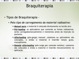 Braquiterapia 
Tipos de Braquiterapia - 
Pelo tipo de carregamento ddoo mmaatteerriiaall rraaddiiooaattiivvoo:: 
MMaannuuaall ppuurraa: o material é colocado diretamente no tecido alvo 
PPrréé-llooaaddiinngg: os aplicadores que conterão as fontes radioativas, 
serão carregadosmanualmente e momentos antes da inserção no 
paciente. 
AAfftteerrllooaaddiinngg (pós-garga) manual: cateteres ou aplicadores são 
colocados, e então o material é inserido nesses guias, 
manualmente 
RReemmoottee aafftteerrllooaaddiinngg (pós-carga por controle remoto): cateteres 
são colocados e então o material é inserido mecanicamente na 
aplicação. 
 