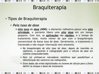 Braquiterapia 
Tipos de Braquiterapia 
PPeellaa ttaaxxaa ddee ddoossee 
AAllttaa ttaaxxaa de ddoossee ((HHDDRR)): o elemento radioativo possui uma aallttaa 
aattiivviiddaaddee, e portanto libera uma aallttaa ddoossee em um tempo 
pequeno. Com isto, as aapplliiccaaççõõeess são rrááppiiddaass, e o tempo de 
tratamento total, muito menor do que com a braquiterapia 
convencional de baixa taxa de dose. Geralmente, o tratamento é 
fracionado e não requer internação nem anestesia. 
NNaa bbrraaqquuiitteerraappiiaa ddee aallttaa ttaaxxaa ddee ddoossee,, ddeeppooiiss ddee iinnsseerriiddooss ooss 
ccaatteetteerreess,, oo ppaacciieennttee éé rraaddiiooggrraaffaaddoo ppaarraa oo ccáállccuulloo ddaa ddoossee eemm 
ssiisstteemmaa ccoommppuuttaaddoorriizzaaddoo.. 
PPaarraa ttaall uuttiilliizzaamm--ssee mmaarrccaaddoorreess mmeettáálliiccooss qquuee ppoossssiibbiilliittaamm aa 
iiddeennttiiffiiccaaççããoo ddooss ccaatteetteerreess nnaass rraaddiiooggrraaffiiaass.. 
EEsstteess ddaaddooss ssããoo eennttããoo ddiiggiittaalliizzaaddooss nnoo ssiisstteemmaa ddee ccáállccuulloo ppaarraa oo ffííssiiccoo 
ddeeffiinniirr ooss tteemmppooss ee ddoosseess ddee ttrraattaammeennttoo 
 