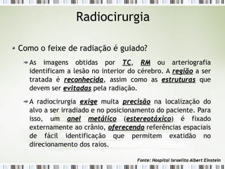 Radiocirurgia 
Como o feixe de radiação é guiado? 
As imagens obtidas por TTCC, RRMM ou arteriografia 
identificam a lesão no interior do cérebro. A rreeggiiããoo a ser 
tratada é rreeccoonnhheecciiddaa, assim como as eessttrruuttuurraass que 
devem ser eevviittaaddaass pela radiação. 
A radiocirurgia eexxiiggee muita pprreecciissããoo na localização do 
alvo a ser irradiado e no posicionamento do paciente. Para 
isso, um aanneell mmeettáálliiccoo (eesstteerreeoottááxxiiccoo) é fixado 
externamente ao crânio, ooffeerreecceennddoo referências espaciais 
de fácil identificação que permitem exatidão no 
direcionamento dos raios. 
FFoonnttee:: HHoossppiittaall IIssrraaeelliittaa AAllbbeerrtt EEiinnsstteeiinn 
 