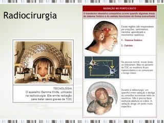 Radiocirurgia 
 