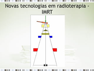 Novas tecnologias em radioterapia - 
IMRT 
 