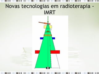 Novas tecnologias em radioterapia - 
IMRT 
 