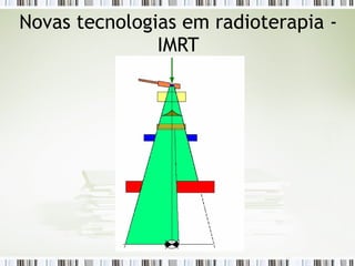 Novas tecnologias em radioterapia - 
IMRT 
 