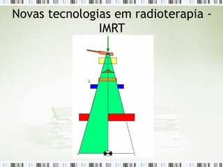 Novas tecnologias em radioterapia - 
IMRT 
 