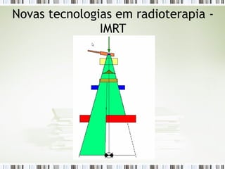 Novas tecnologias em radioterapia - 
IMRT 
 