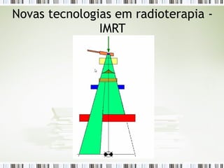 Novas tecnologias em radioterapia - 
IMRT 
 
