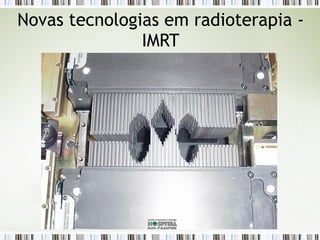 Novas tecnologias em radioterapia - 
IMRT 
 