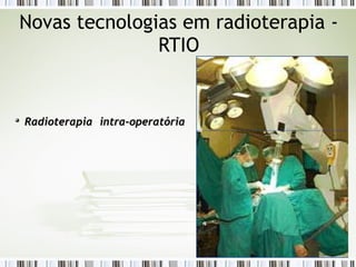 Novas tecnologias em radioterapia - 
RTIO 
Radioterapia iinnttrraa--ooppeerraattóórriiaa 
 