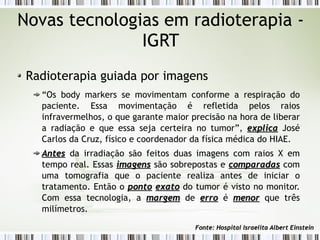 Novas tecnologias em radioterapia - 
IGRT 
Radioterapia guiada por imagens 
“Os body markers se movimentam conforme a respiração do 
paciente. Essa movimentação é refletida pelos raios 
infravermelhos, o que garante maior precisão na hora de liberar 
a radiação e que essa seja certeira no tumor”, eexxpplliiccaa José 
Carlos da Cruz, físico e coordenador da física médica do HIAE. 
AAnntteess da irradiação são feitos duas imagens com raios X em 
tempo real. Essas iimmaaggeennss são sobrepostas e ccoommppaarraaddaass com 
uma tomografia que o paciente realiza antes de iniciar o 
tratamento. Então o ppoonnttoo eexxaattoo do tumor é visto no monitor. 
Com essa tecnologia, a mmaarrggeemm de eerrrroo é mmeennoorr que três 
milímetros. 
FFoonnttee:: HHoossppiittaall IIssrraaeelliittaa AAllbbeerrtt EEiinnsstteeiinn 
 