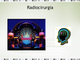Radiocirurgia 
 