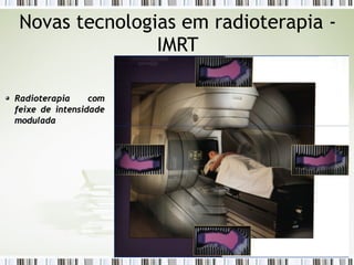 Novas tecnologias em radioterapia - 
IMRT 
RRaaddiiootteerraappiiaa ccoomm 
ffeeiixxee ddee iinntteennssiiddaaddee 
mmoodduullaaddaa 
 