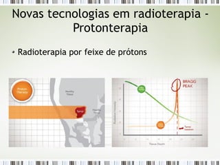 Novas tecnologias em radioterapia - 
Protonterapia 
Radioterapia por feixe de prótons 
 