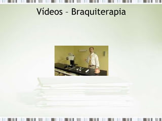 Vídeos – Braquiterapia
 