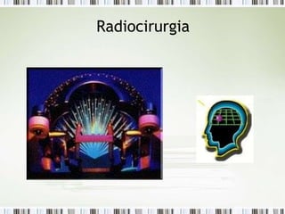 Radiocirurgia
 