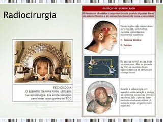 Radiocirurgia
 