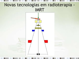 Novas tecnologias em radioterapia -
IMRT
 