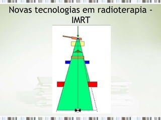 Novas tecnologias em radioterapia -
IMRT
 
