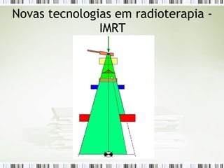 Novas tecnologias em radioterapia -
IMRT
 