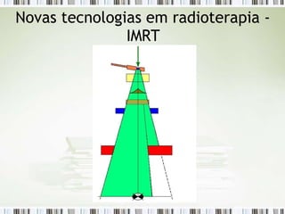 Novas tecnologias em radioterapia -
IMRT
 