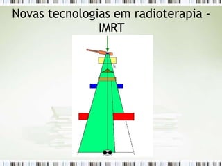 Novas tecnologias em radioterapia -
IMRT
 