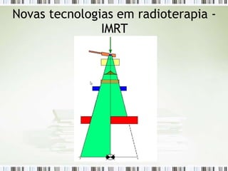 Novas tecnologias em radioterapia -
IMRT
 