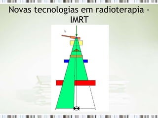 Novas tecnologias em radioterapia -
IMRT
 