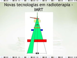 Novas tecnologias em radioterapia -
IMRT
 