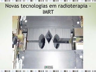 Novas tecnologias em radioterapia -
IMRT
 