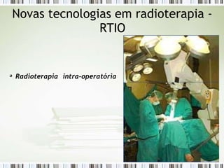 Novas tecnologias em radioterapia -
RTIO
Radioterapia intra-operatória
 