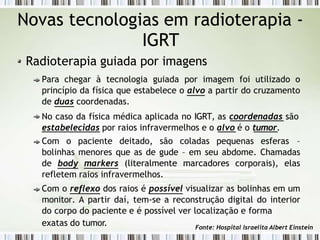 Novas tecnologias em radioterapia -
IGRT
Radioterapia guiada por imagens
Para chegar à tecnologia guiada por imagem foi utilizado o
princípio da física que estabelece o alvo a partir do cruzamento
de duas coordenadas.
No caso da física médica aplicada no IGRT, as coordenadas são
estabelecidas por raios infravermelhos e o alvo é o tumor.
Com o paciente deitado, são coladas pequenas esferas –
bolinhas menores que as de gude – em seu abdome. Chamadas
de body markers (literalmente marcadores corporais), elas
refletem raios infravermelhos.
Com o reflexo dos raios é possível visualizar as bolinhas em um
monitor. A partir daí, tem-se a reconstrução digital do interior
do corpo do paciente e é possível ver localização e forma
exatas do tumor. Fonte: Hospital Israelita Albert Einstein
 