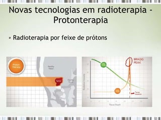Novas tecnologias em radioterapia -
Protonterapia
Radioterapia por feixe de prótons
 