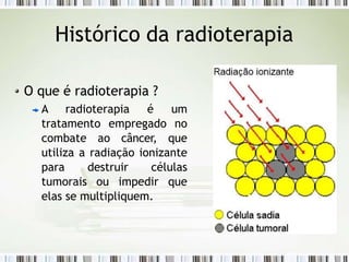 Histórico da radioterapia
O que é radioterapia ?
A radioterapia é um
tratamento empregado no
combate ao câncer, que
utiliza a radiação ionizante
para destruir células
tumorais ou impedir que
elas se multipliquem.
 