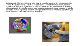 O objetivo da IMRT é concentrar uma maior dose de radiação no volume alvo e poupar os tecidos
normais. A dose de radiação é projetada para conformar a forma tridimensional do tumor pela
modulação ou controle da intensidade dos subcomponentes de cada feixe de radiação. Portanto,
utiliza-se alta dose de radiação no tumor alvo, enquanto se espera diminuir a exposição à radiação
dos tecidos normais adjacentes, buscando a redução da toxicidade ao tratamento. Desta forma, os
efeitos colaterais a curto e longo prazo são reduzidos.
 