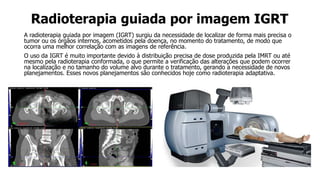 Radioterapia guiada por imagem IGRT
A radioterapia guiada por imagem (IGRT) surgiu da necessidade de localizar de forma mais precisa o
tumor ou os órgãos internos, acometidos pela doença, no momento do tratamento, de modo que
ocorra uma melhor correlação com as imagens de referência.
O uso da IGRT é muito importante devido à distribuição precisa de dose produzida pela IMRT ou até
mesmo pela radioterapia conformada, o que permite a verificação das alterações que podem ocorrer
na localização e no tamanho do volume alvo durante o tratamento, gerando a necessidade de novos
planejamentos. Esses novos planejamentos são conhecidos hoje como radioterapia adaptativa.
 
