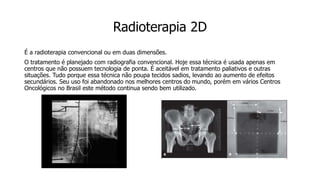 Radioterapia 2D
É a radioterapia convencional ou em duas dimensões.
O tratamento é planejado com radiografia convencional. Hoje essa técnica é usada apenas em
centros que não possuem tecnologia de ponta. É aceitável em tratamento paliativos e outras
situações. Tudo porque essa técnica não poupa tecidos sadios, levando ao aumento de efeitos
secundários. Seu uso foi abandonado nos melhores centros do mundo, porém em vários Centros
Oncológicos no Brasil este método continua sendo bem utilizado.
 