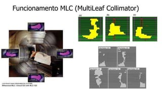 Funcionamento MLC (MultiLeaf Collimator)
 