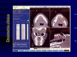 Dosimetria clínica 