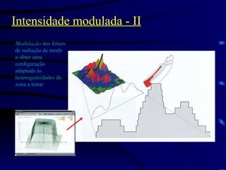 Intensidade modulada - II Modulação  dos feixes de radiação de modo a obter uma configuração adaptada às heterogeneidades da zona a tratar 