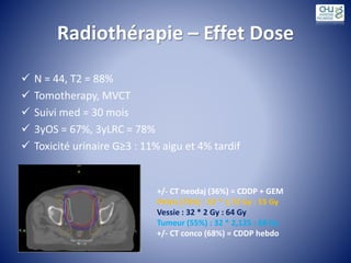 Radiothérapie – Effet Dose
 N = 44, T2 = 88%
 Tomotherapy, MVCT
 Suivi med = 30 mois
 3yOS = 67%, 3yLRC = 78%
 Toxicité urinaire G≥3 : 11% aigu et 4% tardif
+/- CT neodaj (36%) = CDDP + GEM
Pelvis (73%) : 32 * 1,72 Gy : 55 Gy
Vessie : 32 * 2 Gy : 64 Gy
Tumeur (55%) : 32 * 2,125 : 68 Gy
+/- CT conco (68%) = CDDP hebdo
 