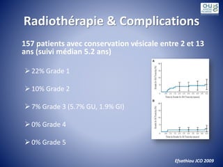 Radiothérapie & Complications
157 patients avec conservation vésicale entre 2 et 13
ans (suivi médian 5.2 ans)
22% Grade 1
10% Grade 2
7% Grade 3 (5.7% GU, 1.9% GI)
0% Grade 4
0% Grade 5
Efsathiou JCO 2009
 
