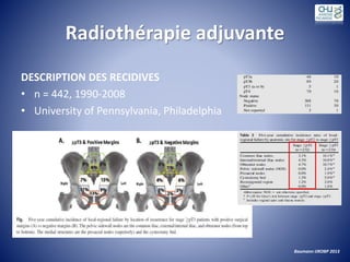 Radiothérapie adjuvante
DESCRIPTION DES RECIDIVES
• n = 442, 1990-2008
• University of Pennsylvania, Philadelphia
Baumann IJROBP 2013
 