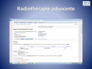 Radiothérapie adjuvante
 