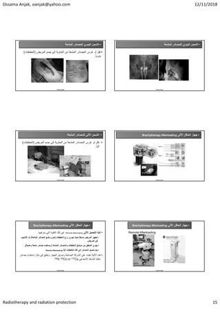 Ossama Anjak, oanjak@yahoo.com 12/11/2018
Radiotherapy and radiation protection 15
•
‫ﺍﻟﻣﺷﻌﺔ‬ ‫ﻟﻠﻣﺻﺎﺩﺭ‬ ‫ﺍﻟﻳﺩﻭﻱ‬ ‫ﺍﻟﺷﺣﻥ‬
•
‫ﺍﻟﻣﺭﻳﺽ‬ ‫ﺟﺳﻡ‬ ‫ﺇﻟﻰ‬ ‫ﺍﻟﺣﺎﻭﻳﺔ‬ ‫ﻣﻥ‬ ‫ﺍﻟﻣﺷﻌﺔ‬ ‫ﺍﻟﻣﺻﺎﺩﺭ‬ ‫ﻏﺭﺱ‬ ‫ﺃﻭ‬ ‫ﻧﻘﻝ‬
)
‫ﺍﻟﻣﻁﺑﻘﺎﺕ‬
(
ً‫ﺎ‬‫ﻳﺩﻭﻳ‬
.
Ossama Anjak
•
‫ﺍﻟﻣﺷﻌﺔ‬ ‫ﻟﻠﻣﺻﺎﺩﺭ‬ ‫ﺍﻟﻳﺩﻭﻱ‬ ‫ﺍﻟﺷﺣﻥ‬
Ossama Anjak
•
‫ﺍﻟﻣﺷﻌﺔ‬ ‫ﻟﻠﻣﺻﺎﺩﺭ‬ ‫ﺍﻵﻟﻲ‬ ‫ﺍﻟﺷﺣﻥ‬
•
‫ﺍﻟﻣﺭﻳﺽ‬ ‫ﺟﺳﻡ‬ ‫ﺇﻟﻰ‬ ‫ﺍﻟﺣﺎﻭﻳﺔ‬ ‫ﻣﻥ‬ ‫ﺍﻟﻣﺷﻌﺔ‬ ‫ﺍﻟﻣﺻﺎﺩﺭ‬ ‫ﻏﺭﺱ‬ ‫ﺃﻭ‬ ‫ﻧﻘﻝ‬
)
‫ﺍﻟﻣﻁﺑﻘﺎﺕ‬
(
ً‫ﺎ‬‫ﺁﻟﻳ‬
.
Ossama Anjak
•
‫ﺍﻵﻟﻲ‬ ‫ﺍﻟﺣﺎﻗﻥ‬ ‫ﺟﻬﺎﺯ‬
Brachytherapy Afterloading
Ossama Anjak
•
‫ﺍﻵﻟﻲ‬ ‫ﺍﻟﺣﺎﻗﻥ‬ ‫ﺟﻬﺎﺯ‬
Brachytherapy Afterloading
•
‫ﺍﻵﻟﻲ‬ ‫ﺍﻟﺗﺣﻣﻳﻝ‬ ‫ﺁﻟﻳﺔ‬
Remote Afterloading
:
‫ﻓﻳﻬﺎ‬ ‫ﻳﺗﻡ‬ ‫ﺍﻟﺗﻲ‬ ‫ﺍﻟﺗﻘﻧﻳﺔ‬ ‫ﺗﻠﻙ‬ ‫ﻫﻲ‬
:
•
‫ﺍﻟﻣﻁﺑﻘﺎﺕ‬ ‫ﺯﺭﻉ‬ ‫ﻳﺟﺭﻱ‬ ‫ﺣﻳﺙ‬ ً‫ﺎ‬‫ﻣﺳﺑﻘ‬ ‫ﺍﻟﻣﺭﻳﺽ‬ ‫ﺗﺟﻬﻳﺯ‬
)
‫ﺍﻟﻣﺷﻌﺔ‬ ‫ﺍﻟﻣﺻﺎﺩﺭ‬ ‫ﻭﺿﻊ‬ ‫ﺩﻭﻥ‬
(
‫ﺍﻷﻧﺎ‬ ‫ﺃﻭ‬
‫ﺑﻳﺏ‬
‫ﺍﻟﻣﺭﻳﺽ‬ ‫ﻓﻲ‬
.
•
‫ﺍﻟﻣﺷﻌﺔ‬ ‫ﻭﺍﻟﻣﺻﺎﺩﺭ‬ ‫ﺍﻟﻣﻁﺑﻘﺎﺕ‬ ‫ﻣﻭﺿﻊ‬ ‫ﻣﻥ‬ ‫ﺍﻟﺗﺣﻘﻖ‬ ‫ﻳﺟﺭﻱ‬
)
‫ﻭﻫﻣﻳﺔ‬ ‫ﻣﺷﻌﺔ‬ ‫ﻣﺻﺎﺩﺭ‬ ‫ﻳﺳﺗﺧﺩﻡ‬
.(
•
‫ﺍﻟﻣ‬ ‫ﺗﺣﻣﻳﻝ‬ ‫ﻳﺗﻡ‬
‫ﺻﺎﺩﺭ‬
ً‫ﺎ‬‫ﺁﻟﻳ‬ ‫ﺍﻟﻣﻁﺑﻘﺎﺕ‬ ‫ﺗﻠﻙ‬ ‫ﺇﻟﻰ‬
Remote Afterloading
.
•
‫ﺍﺳﺗﺧﺩﺍﻡ‬ ‫ﺣﺎﻝ‬ ‫ﻓﻲ‬ ‫ﻭﺗﻁﺑﻖ‬ ‫ﺍﻟﺟﻬﺎﺯ‬ ‫ﻭﻣﻭﺩﻳﻝ‬ ‫ﺍﻟﺻﺎﻧﻌﺔ‬ ‫ﺍﻟﺷﺭﻛﺔ‬ ‫ﻋﻠﻰ‬ ‫ﺗﻌﺗﻣﺩ‬ ‫ﺍﻵﻟﻳﺔ‬ ‫ﻫﺫﻩ‬
‫ﻣﺻﺎﺩﺭ‬
‫ﺍﻹﺷﻌﺎﻋﻲ‬ ‫ﺍﻟﻧﺷﺎﻁ‬ ‫ﻋﺎﻟﻳﺔ‬
Cs
137
Co or
60
Ir,
192
.
Ossama Anjak
•
‫ﺍﻵﻟﻲ‬ ‫ﺍﻟﺣﺎﻗﻥ‬ ‫ﺟﻬﺎﺯ‬
Brachytherapy Afterloading
Ossama Anjak
Remote Afterloading
ELEKTA
Brachytherapy Afterloading
GyneSource
HDR‐Afterloader
 