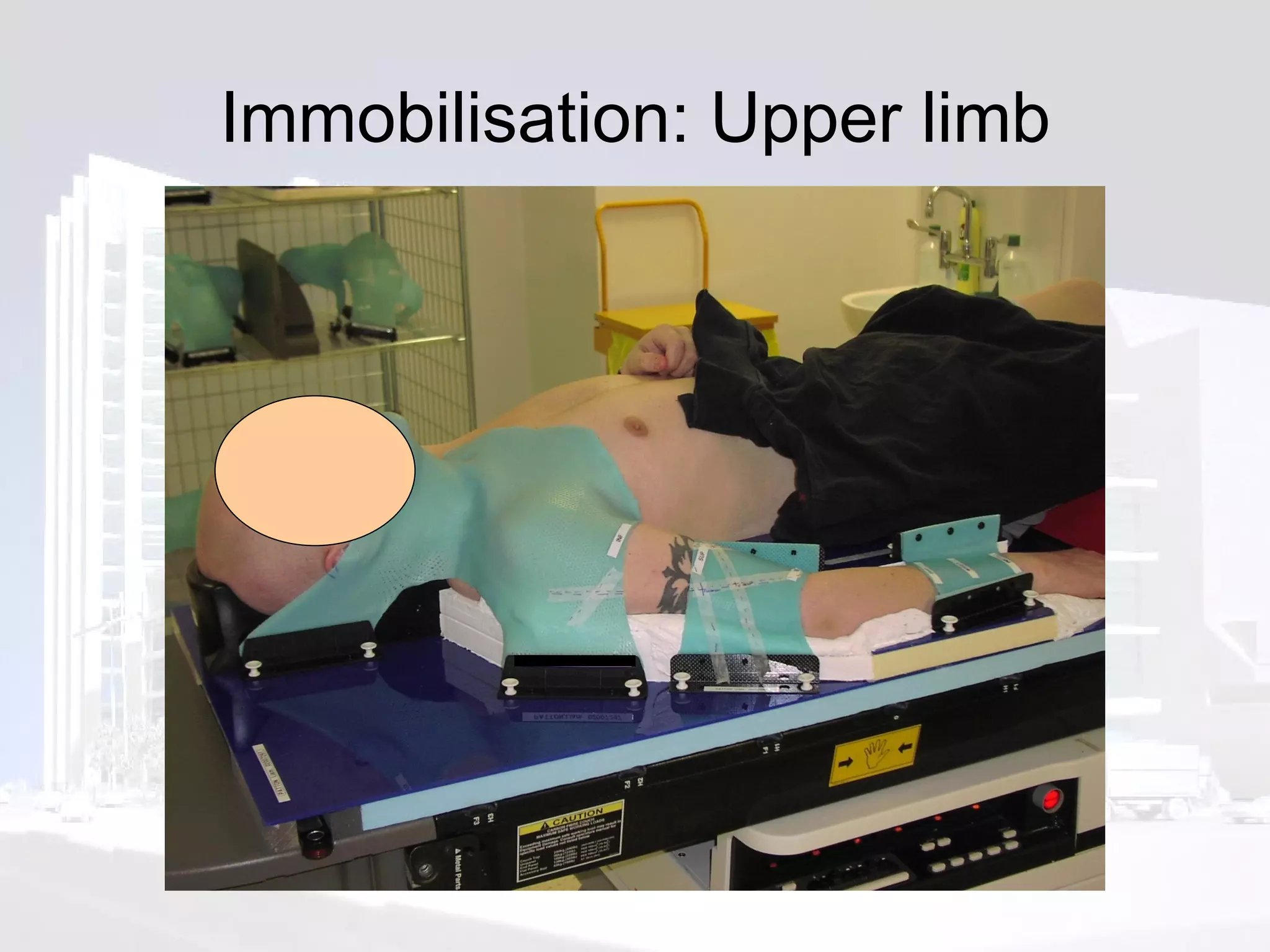 Immobilisation: Upper limb 
