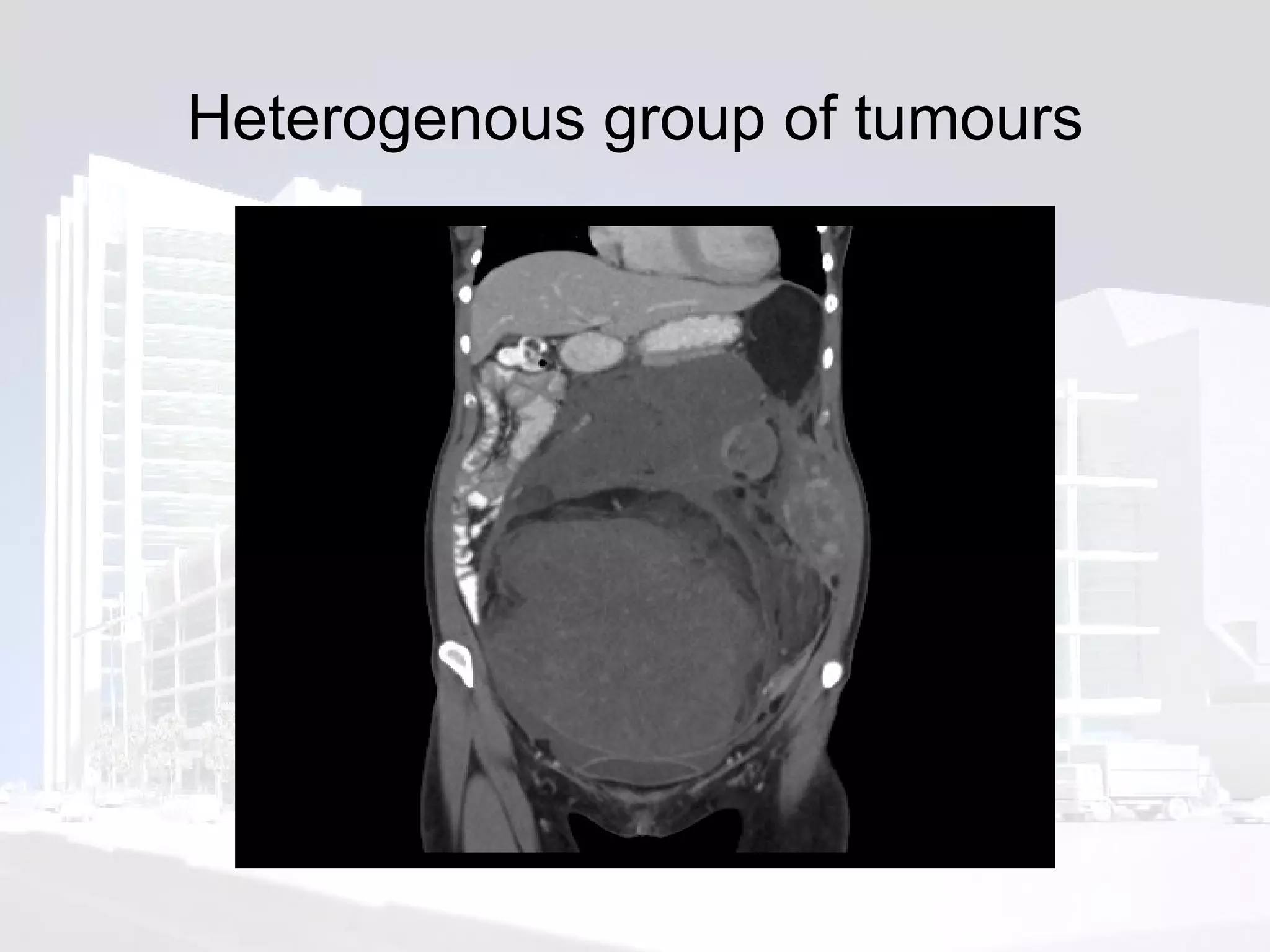 Heterogenous group of tumours 